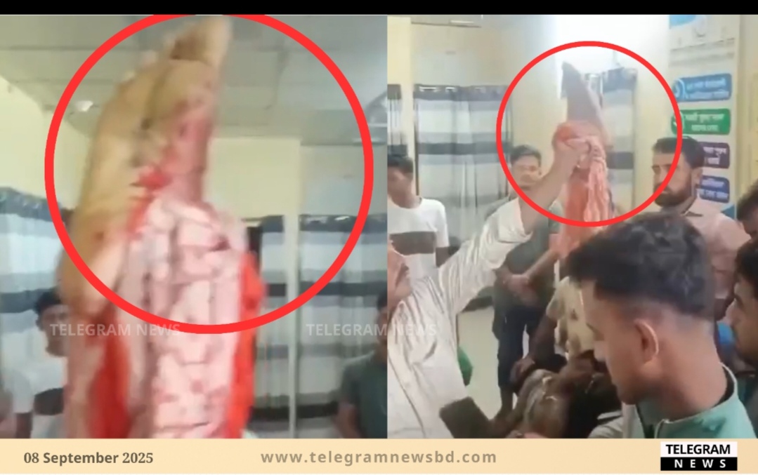 মহেশখালীতে জমি বিরোধের জেরে পা বিচ্ছিন্ন করে কৃষককে হত্যা